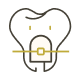 小児矯正