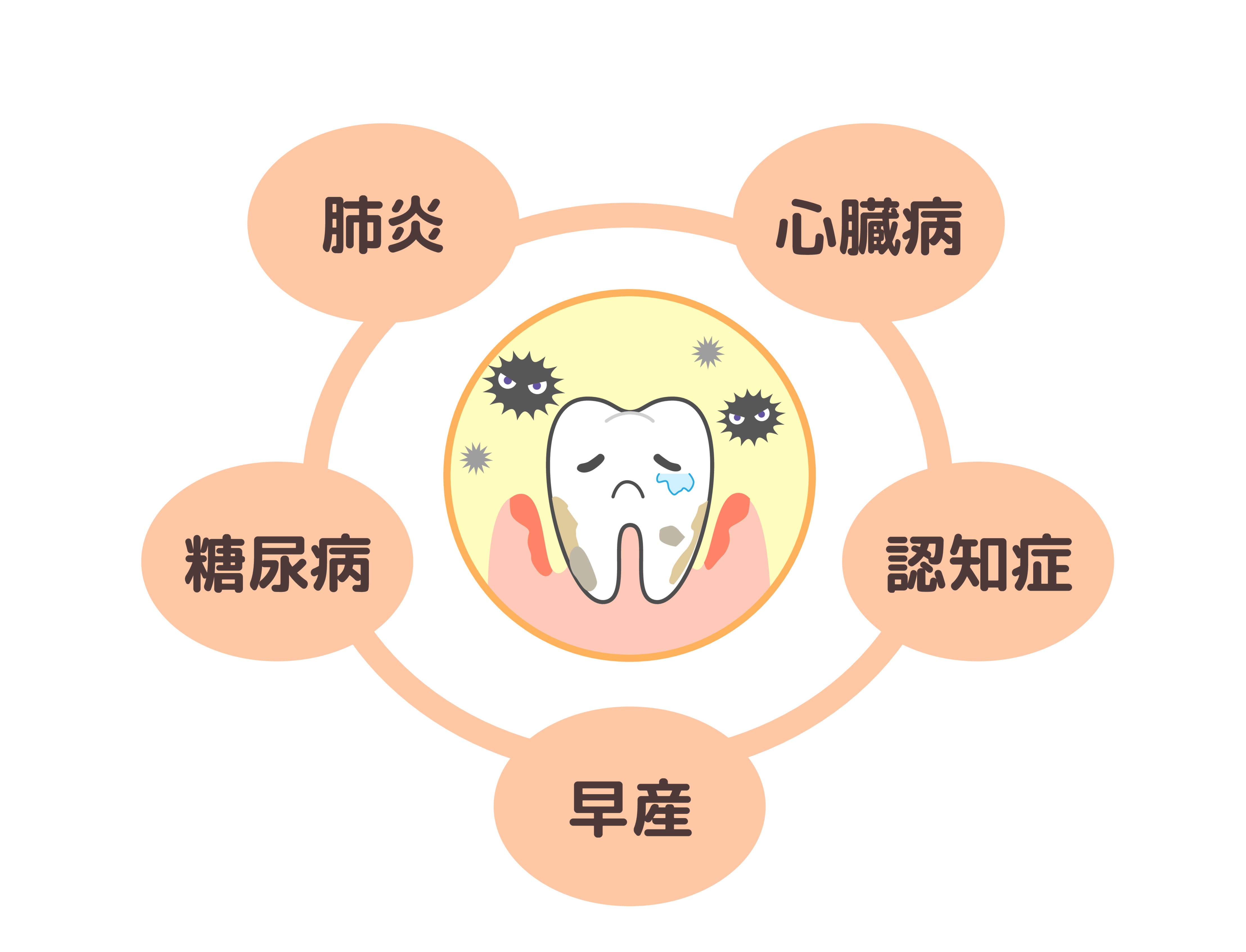 歯周病が全身に及ぼす影響